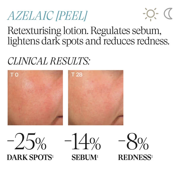 Azelaic (Peel)